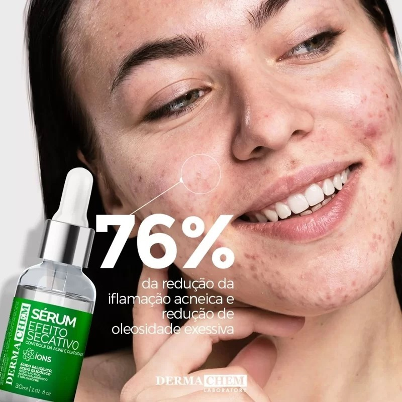 Kit Skincare Limpeza Pele Antioleosidade Pele Oleosa c/ Sérum Faixa e Esponja Promoção